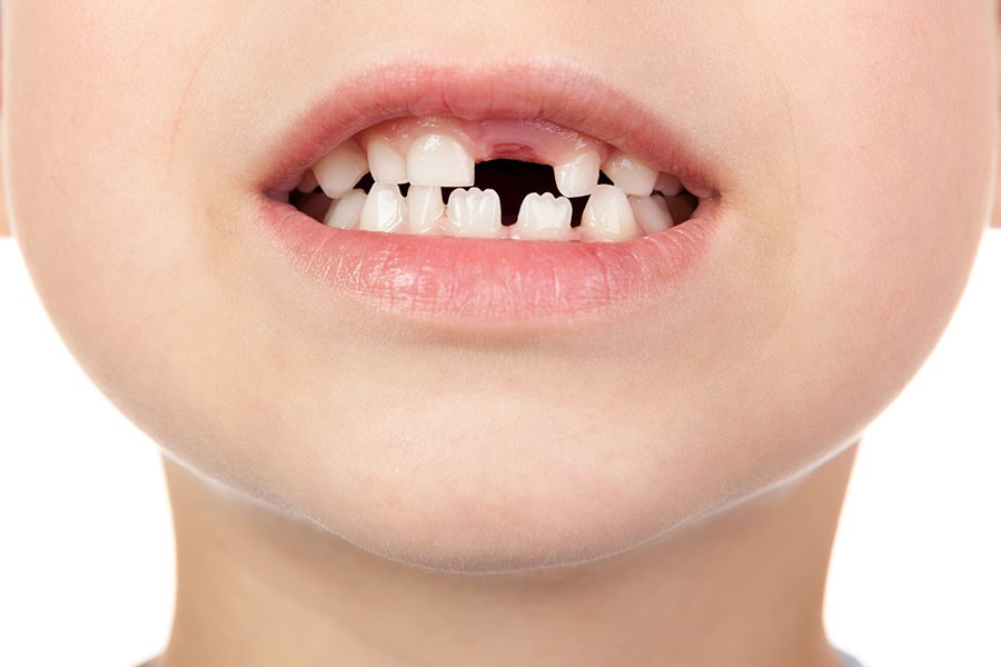 Odontoiatria Pediatrica