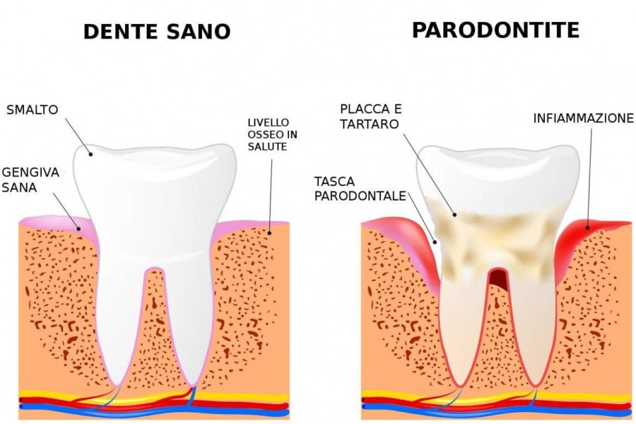 Parodontologia